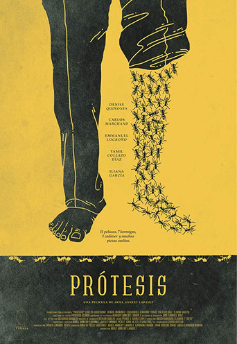 Prosthesis