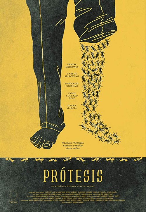 Prosthesis